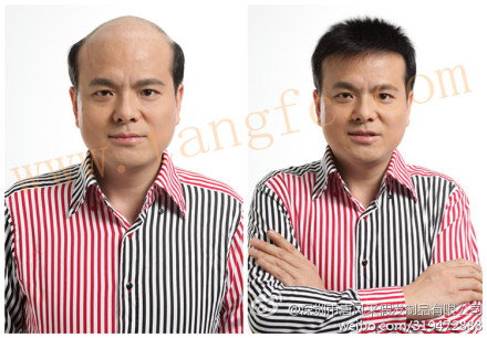 男士假發專賣店 如何選擇男士假發專賣店?這類人易得雄脫