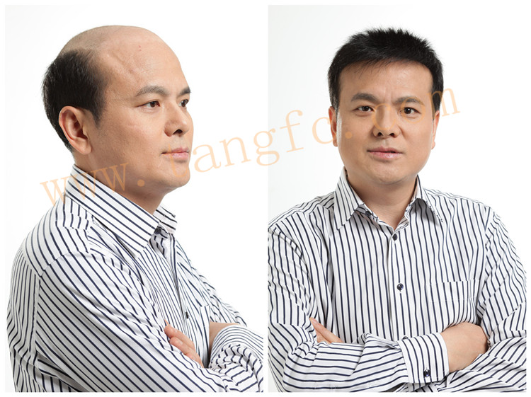 佛山男士補發哪里好 佛山男士補發哪里好?要想超薄透氣還帥氣就得找唐風采!