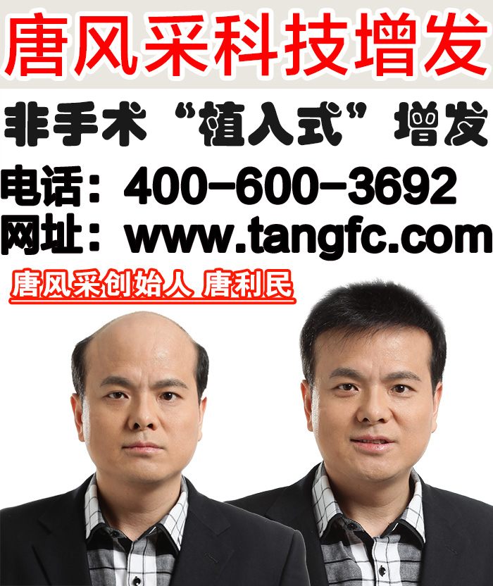真人發中年男士假發多少錢？中年人為何易禿