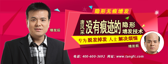 在佛山有哪些織發補發店？唐風采這家怎么樣？