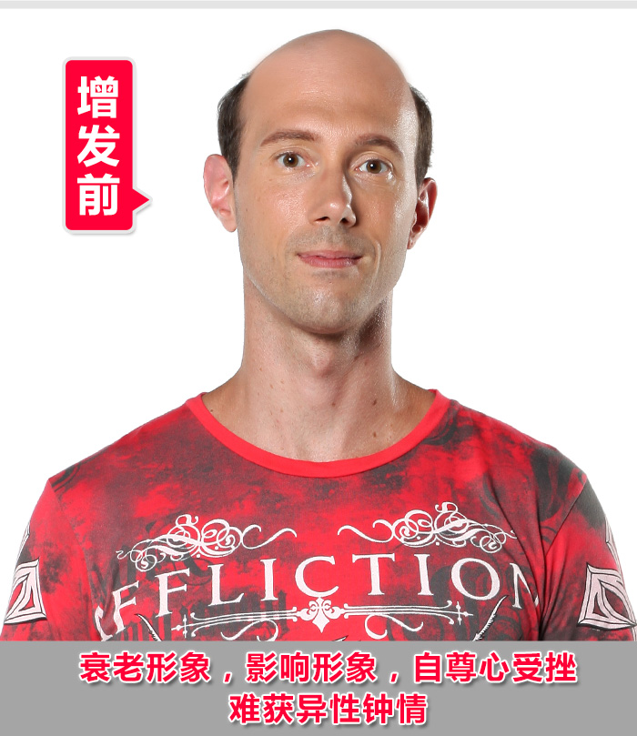 佛山賣假發的地方 佛山賣假發的地方,在唐風采買假發為父親相親!