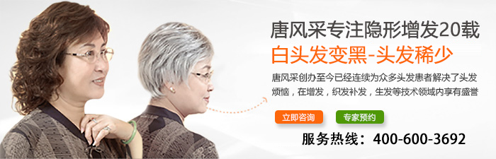長沙假發什么牌子好 長沙假發什么牌子好?千萬別貪小便宜吃了大虧