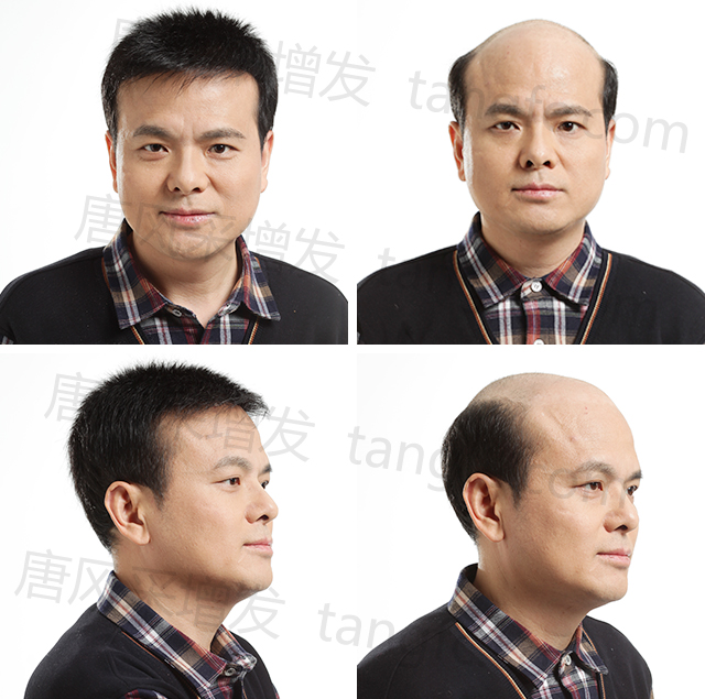 拉薩補發(fā)哪里好 拉薩補發(fā)哪里好?唐風采總是適合你!