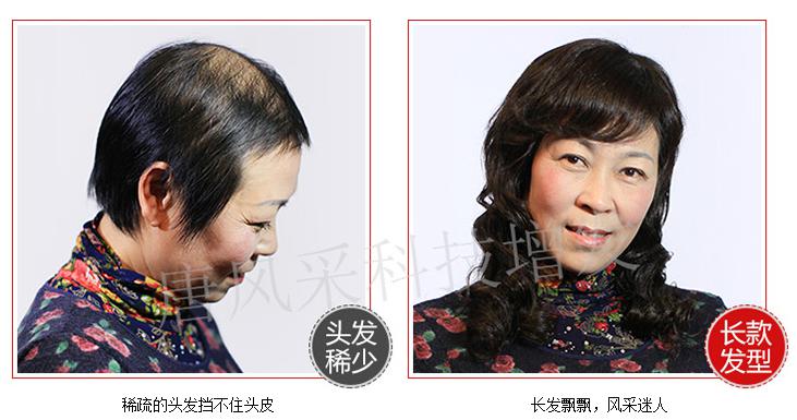 嘉興織發補發中心 嘉興織發補發中心,唐風采專業補發塑造完美形象