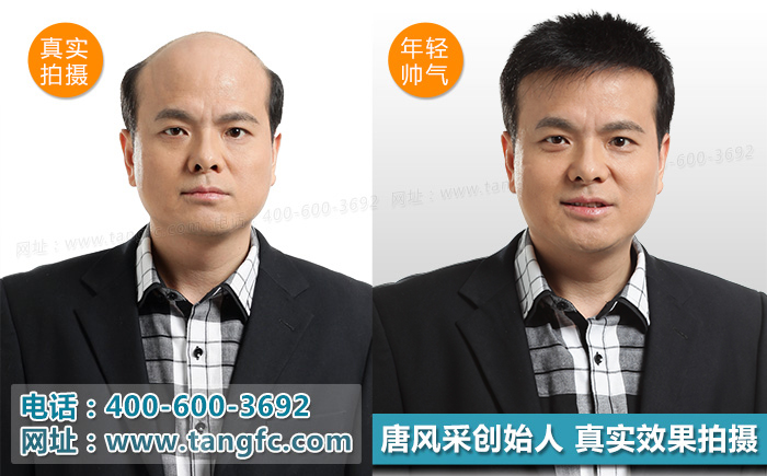 奧尼爾戴白發開懟 奧尼爾戴白發開懟,小伙伴們千萬別模仿!