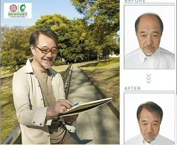 禿頂有救了 來自NASA的黑科技生發(fā)頭盔,禿頂有救了?