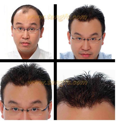 金華哪里有假發(fā)專賣店 哪家假發(fā)適合脫發(fā)人?金華哪里有假發(fā)專賣店?