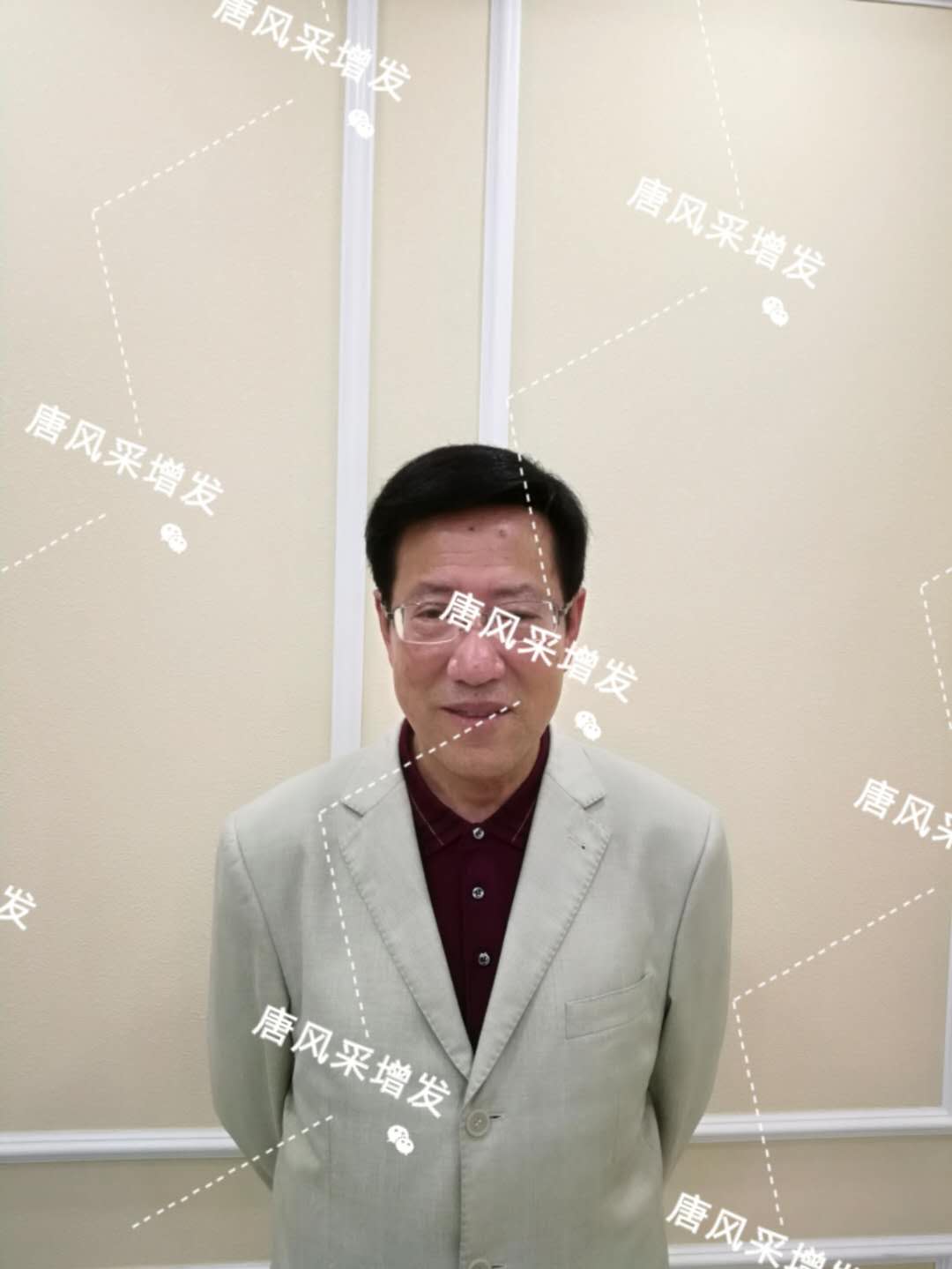 脫發禿頂成中年男人標配 脫發禿頂成中年男人標配?唐風采增發讓您風采始終如一