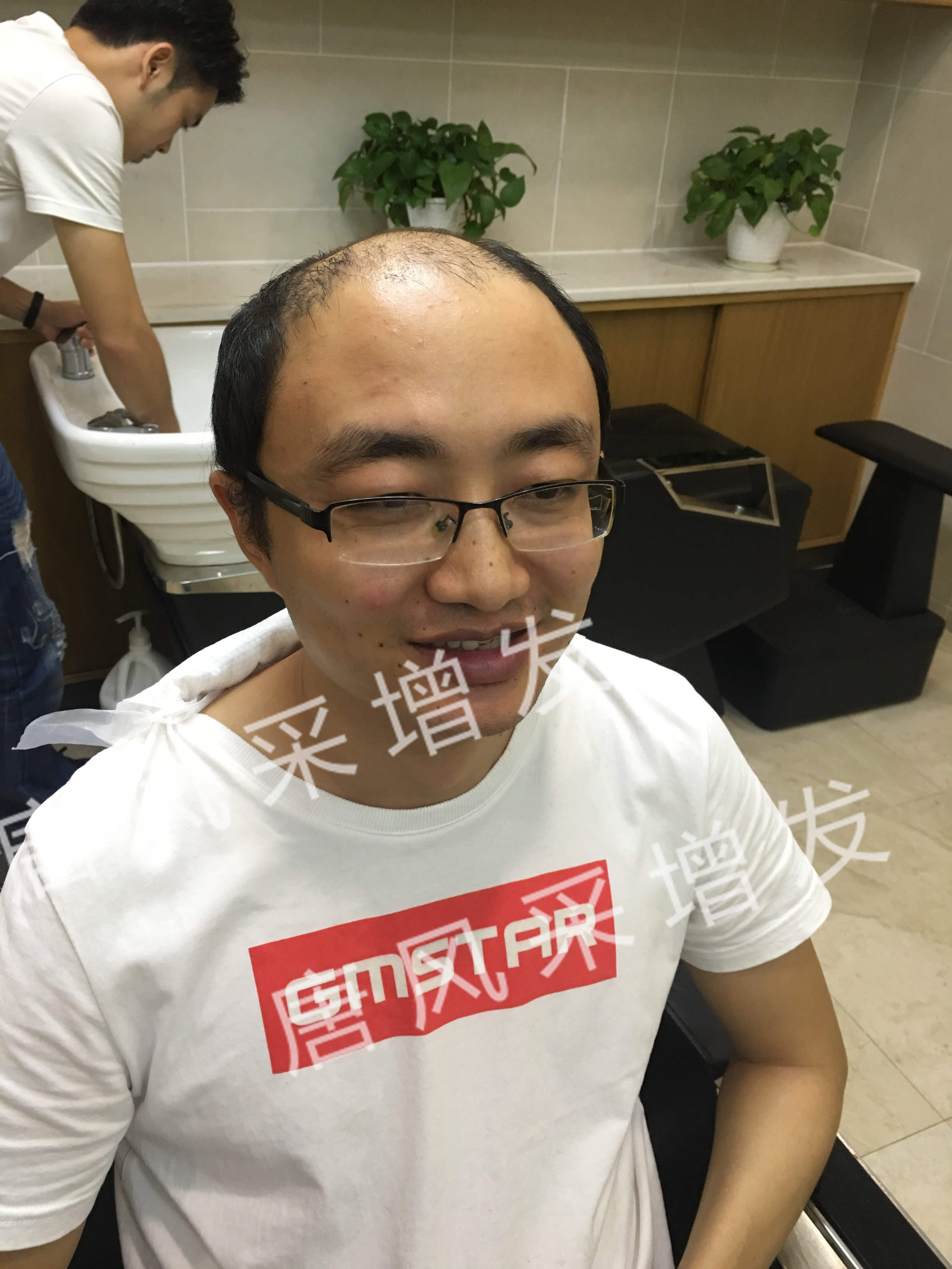 唐風采真實效果 今天咱不看廣告宣傳了,唐風采真實效果,上圖上視頻