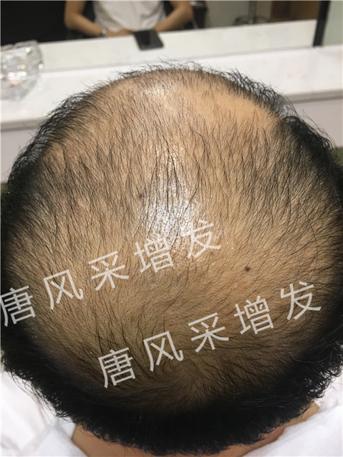 唐風采真實效果 今天咱不看廣告宣傳了,唐風采真實效果,上圖上視頻