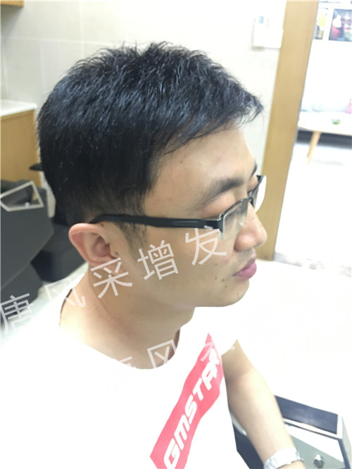 唐風采真實效果 今天咱不看廣告宣傳了,唐風采真實效果,上圖上視頻