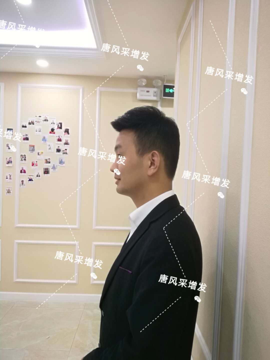 輸了頭發不能輸氣質 輸了頭發不能輸氣質,看帥哥的逆襲之路!
