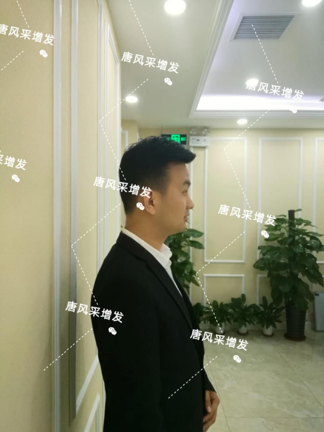 輸了頭發不能輸氣質 輸了頭發不能輸氣質,看帥哥的逆襲之路!