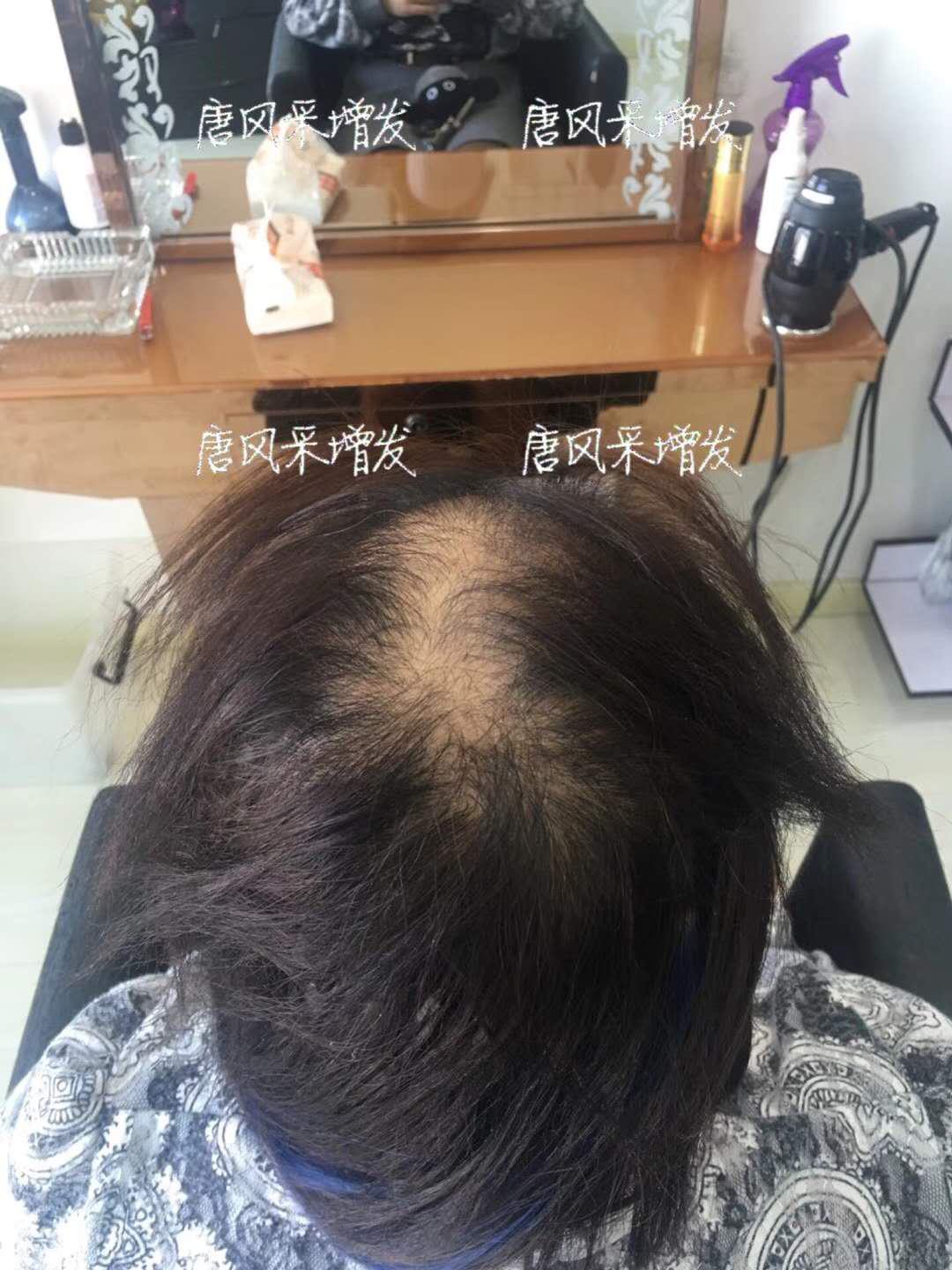 生發 生發了這么久,但凡有效果的也該有些跡象了