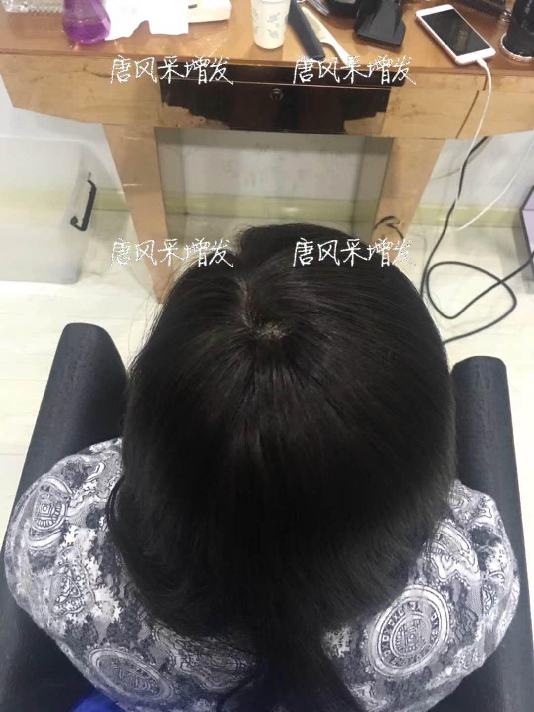 生發 生發了這么久,但凡有效果的也該有些跡象了