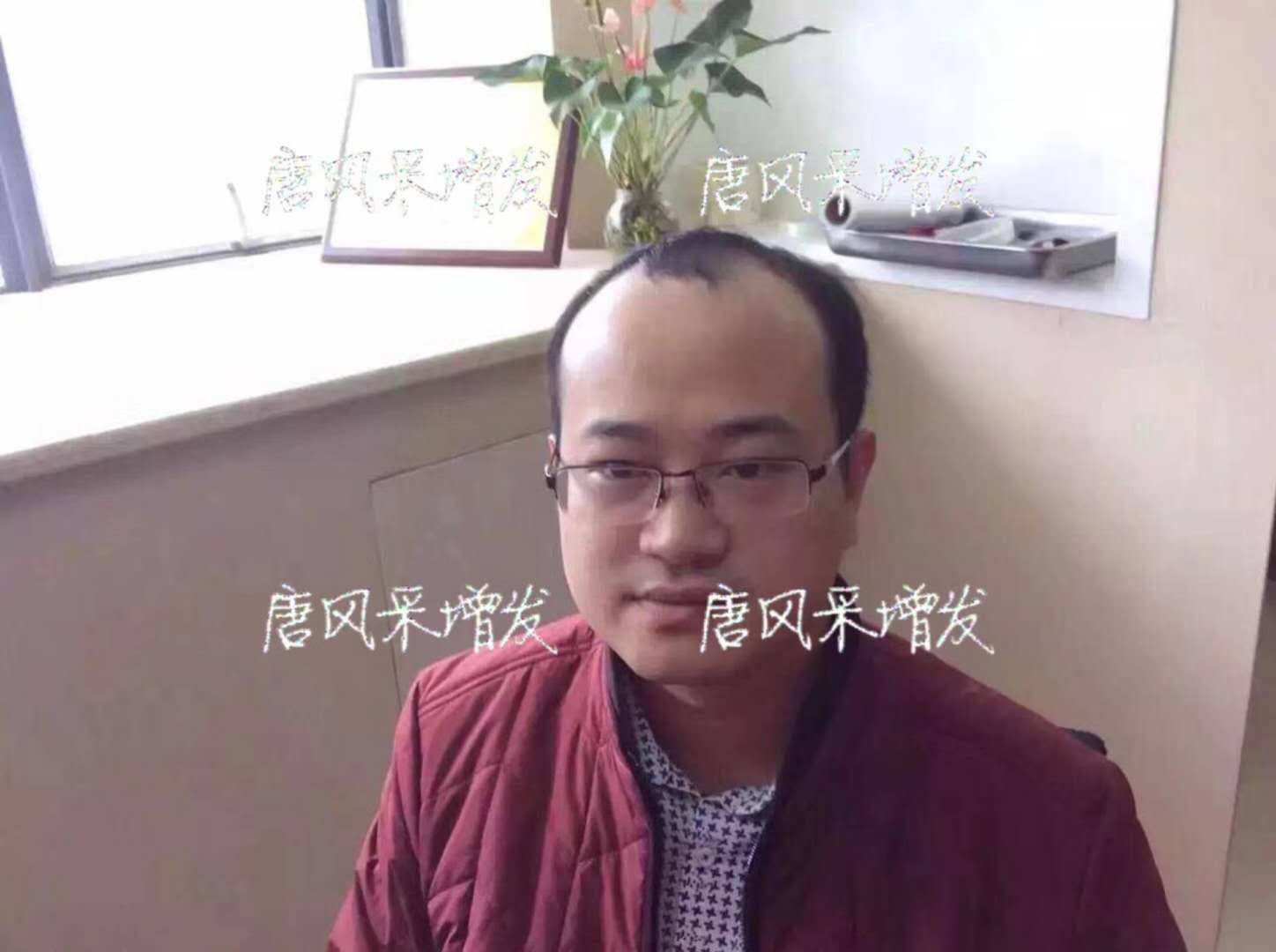 生發 生發了這么久,但凡有效果的也該有些跡象了