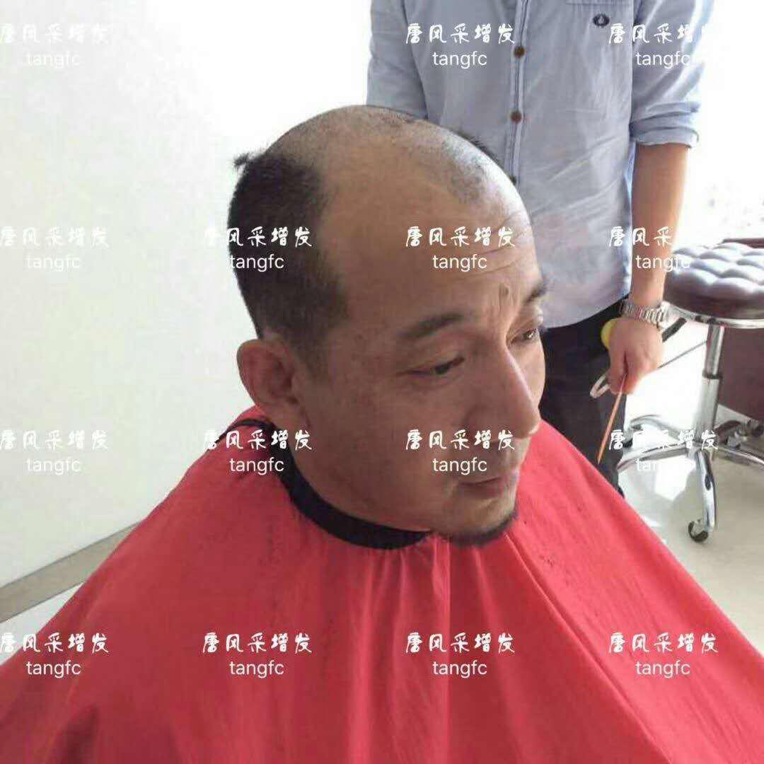 生發 生發了這么久,但凡有效果的也該有些跡象了