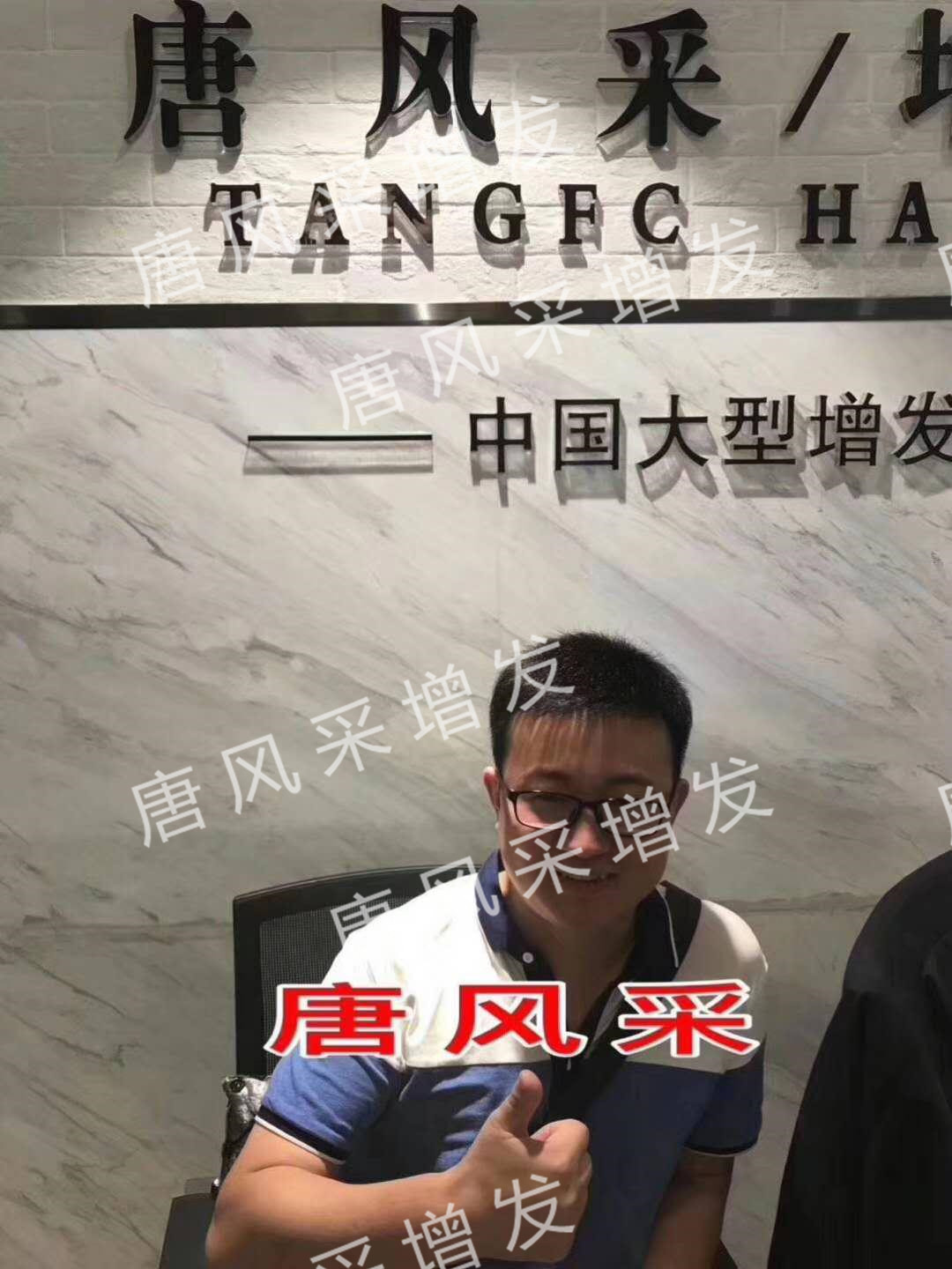 禿頂限制了造型 貧窮限制了想象,禿頂限制了造型?