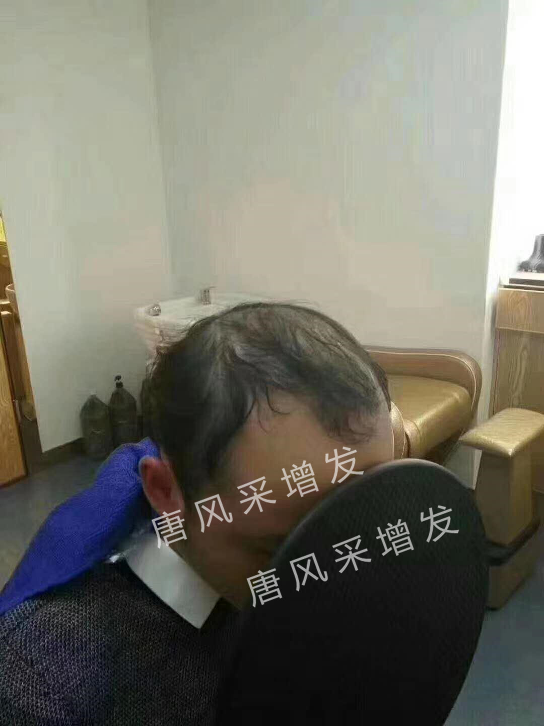 遺傳白發 身為90后,最怕別人喊我“叔”!