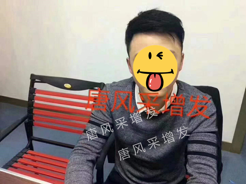 遺傳白發 身為90后,最怕別人喊我“叔”!