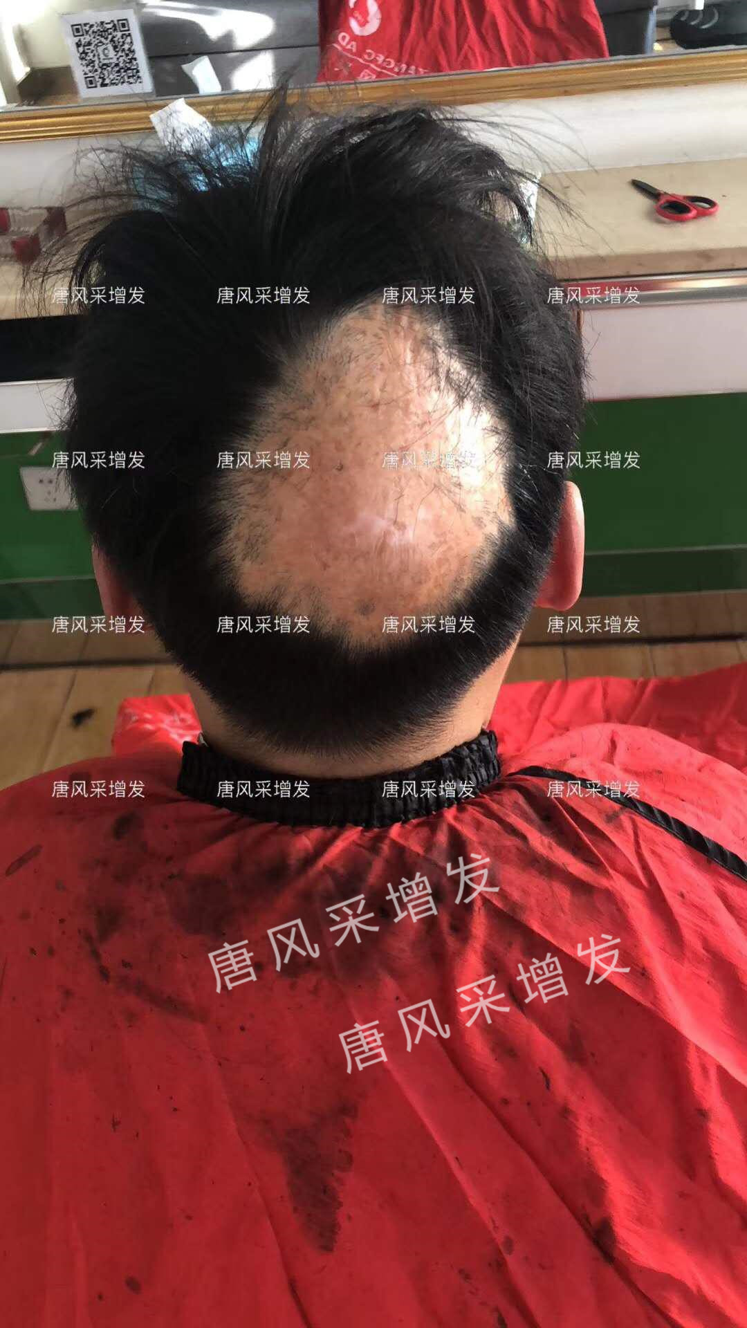遺傳白發 身為90后,最怕別人喊我“叔”!