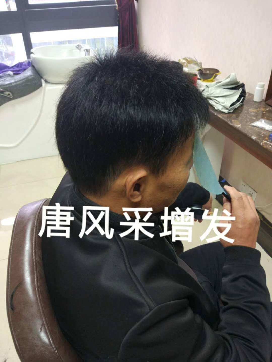 脫發(fā)謝頂 脫發(fā)謝頂壓力大,增發(fā)補(bǔ)發(fā)一身輕!