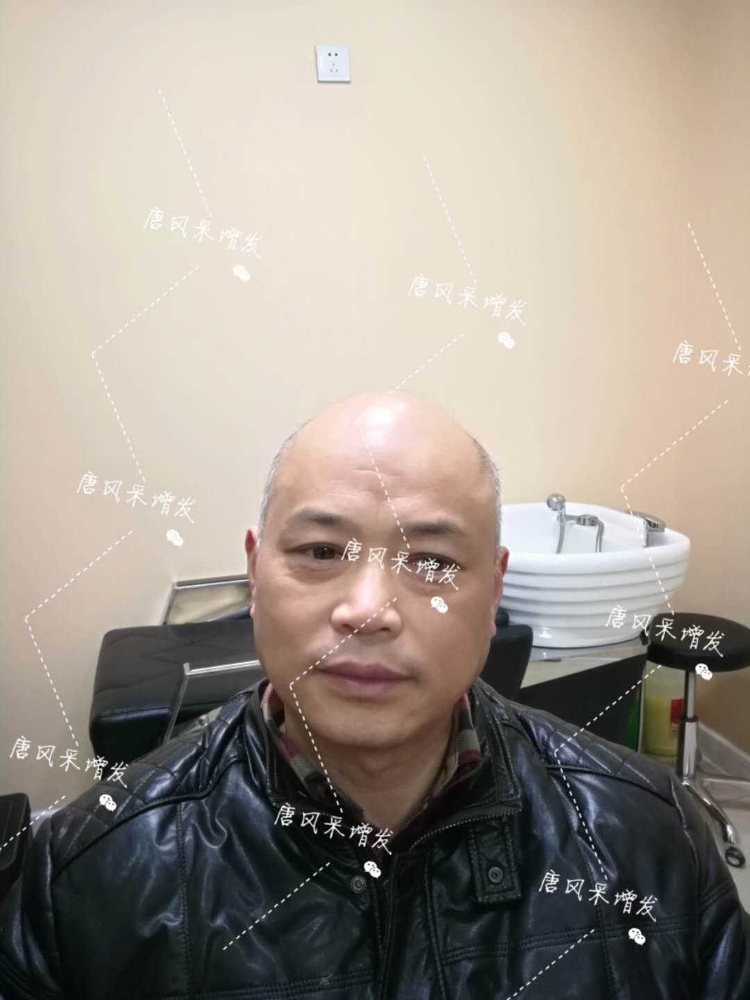 我的天吶！沒想到某防脫洗發(fā)水的老板居然也脫發(fā)了！