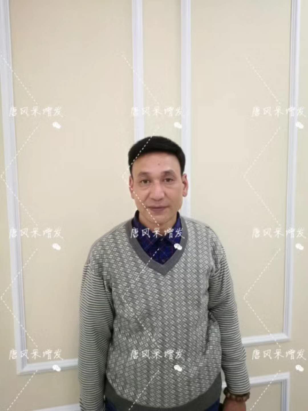 我的天吶！沒想到某防脫洗發(fā)水的老板居然也脫發(fā)了！