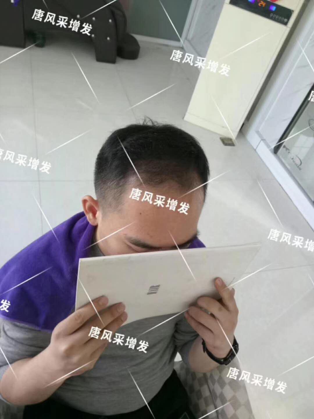 油膩中年男 感覺自尊心好受打擊,朋友說我“頭上的油都夠炒盤菜了...