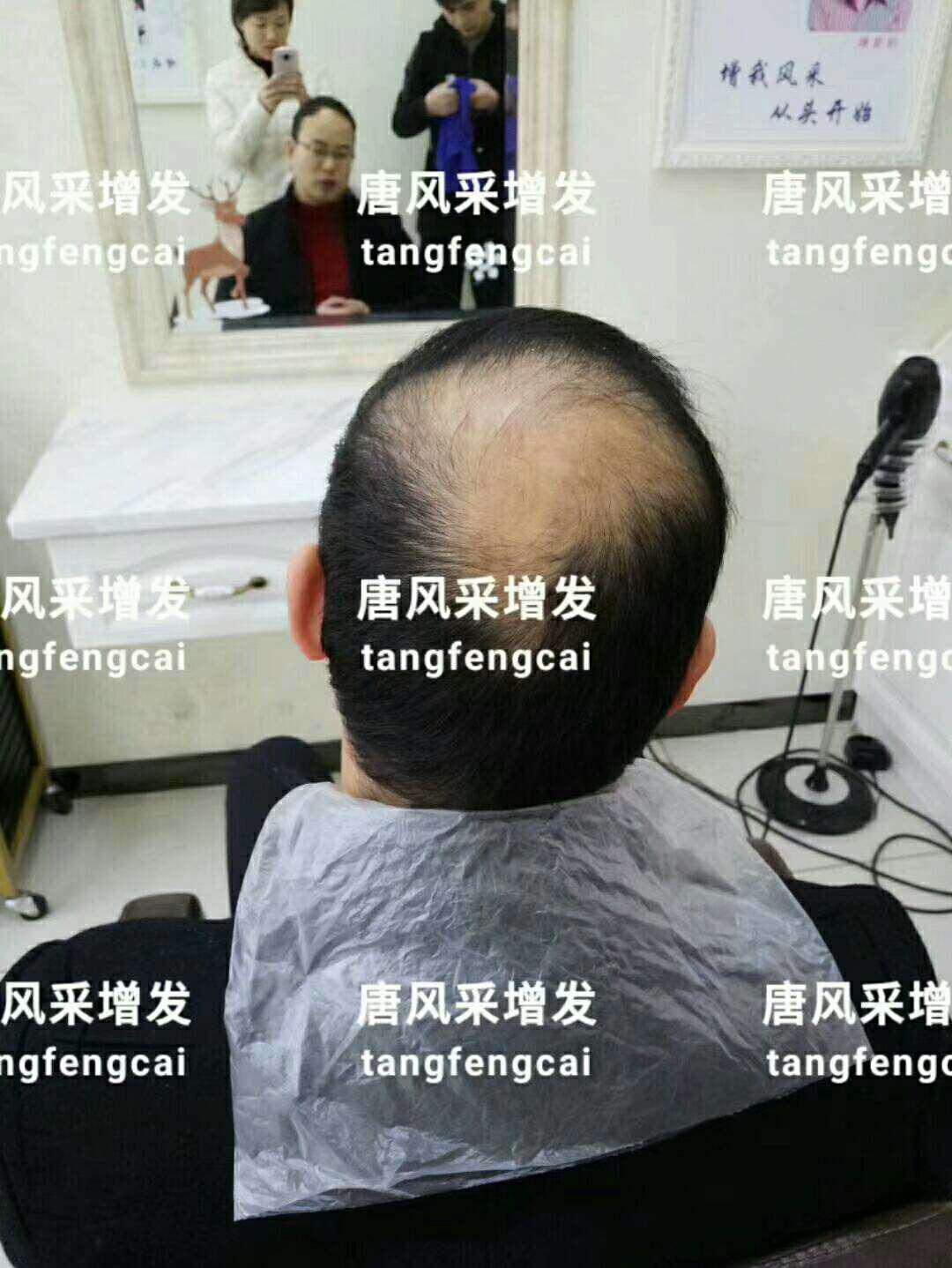  一轉(zhuǎn)眼年輕十歲，你差的就是這點(diǎn)點(diǎn)頭發(fā)！