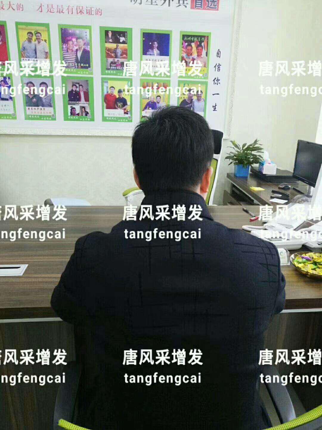  一轉(zhuǎn)眼年輕十歲，你差的就是這點(diǎn)點(diǎn)頭發(fā)！