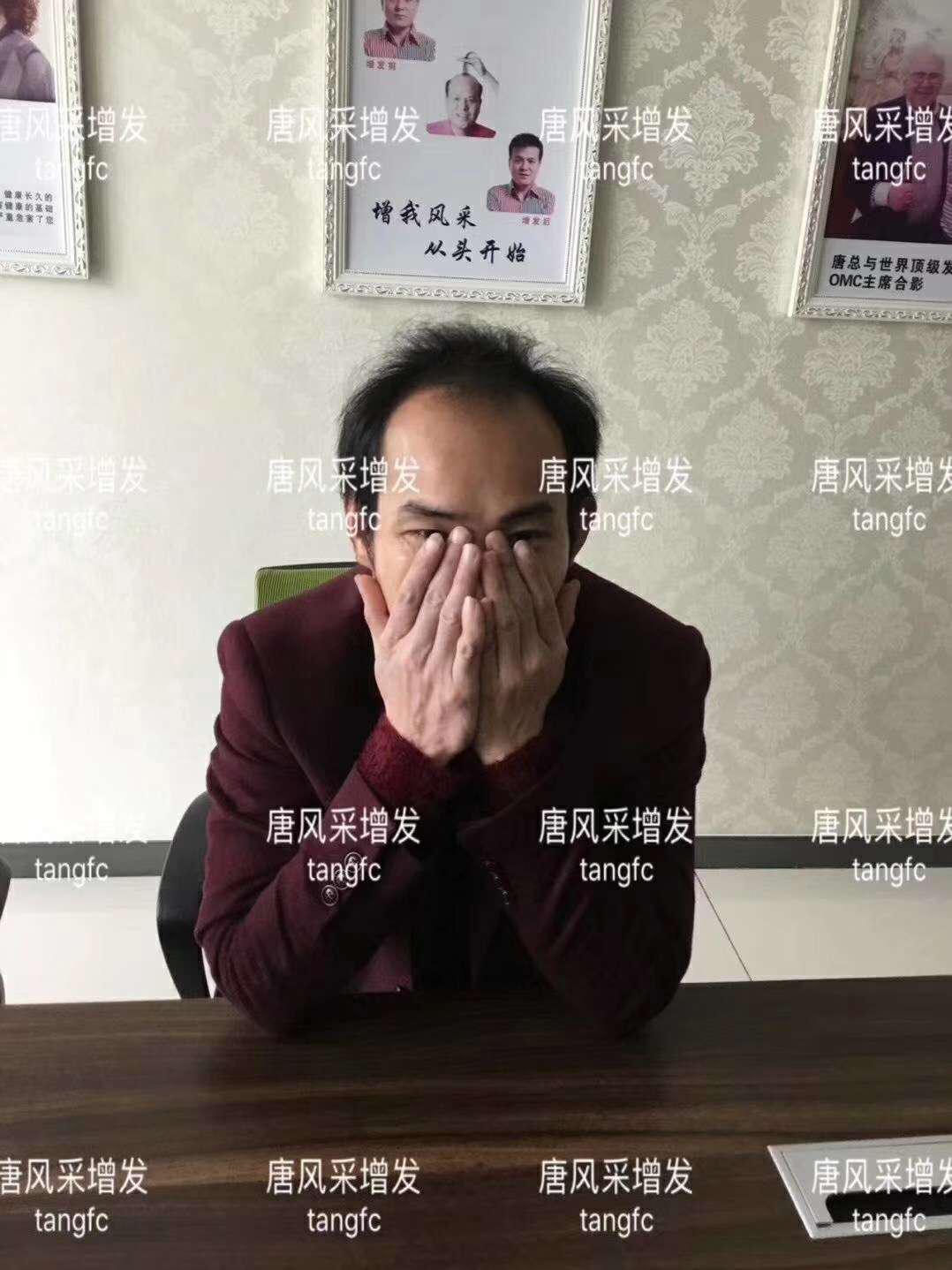 一轉(zhuǎn)眼年輕十歲，你差的就是這點(diǎn)點(diǎn)頭發(fā)！