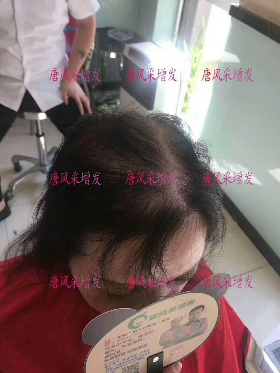 連美顏相機都無法拯救你的頭發？但唐風采可以啊！