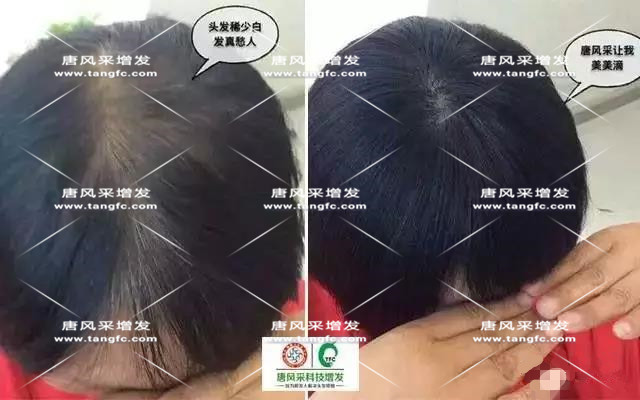 女士假發 女士假發見證華麗轉變,前后差別震撼!