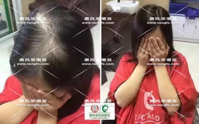 女士假發 女士假發見證華麗轉變,前后差別震撼!