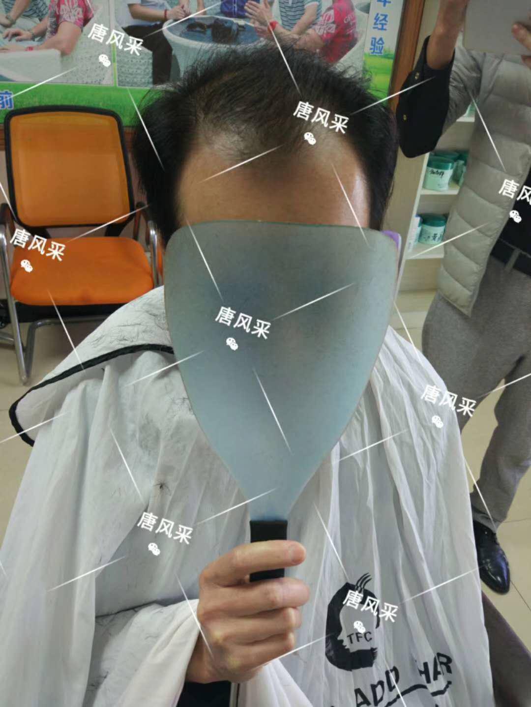 90后脫發 頭發一洗一大把,猝死不是當代年輕人最擔憂的問題,而是