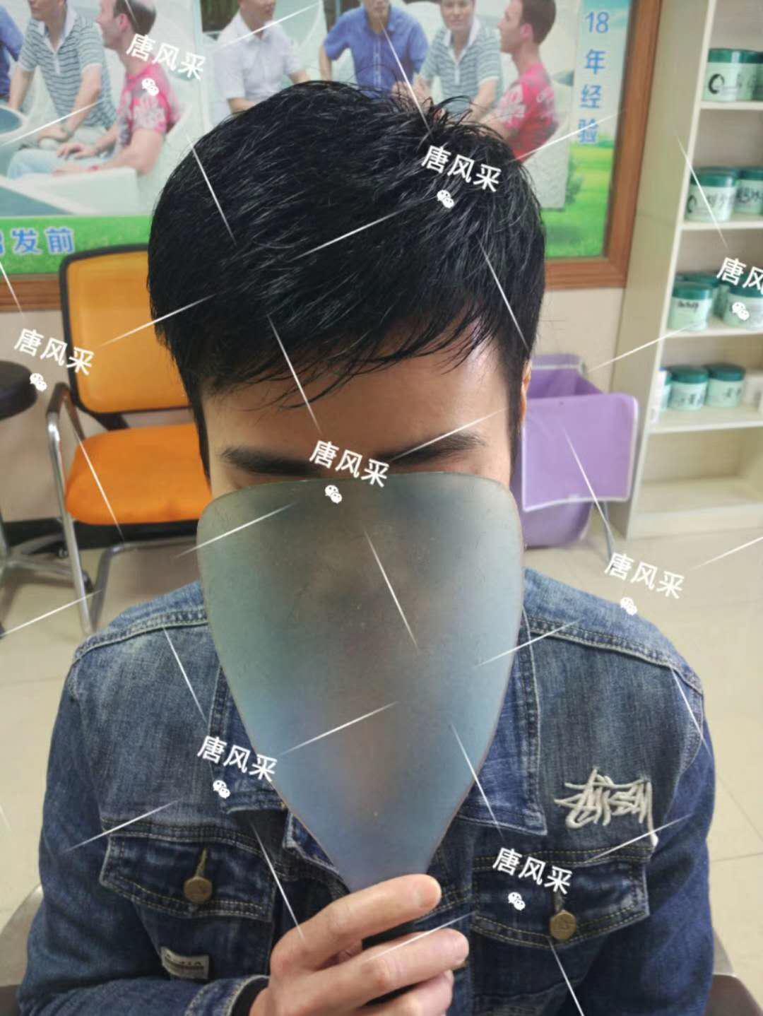 90后脫發 頭發一洗一大把,猝死不是當代年輕人最擔憂的問題,而是