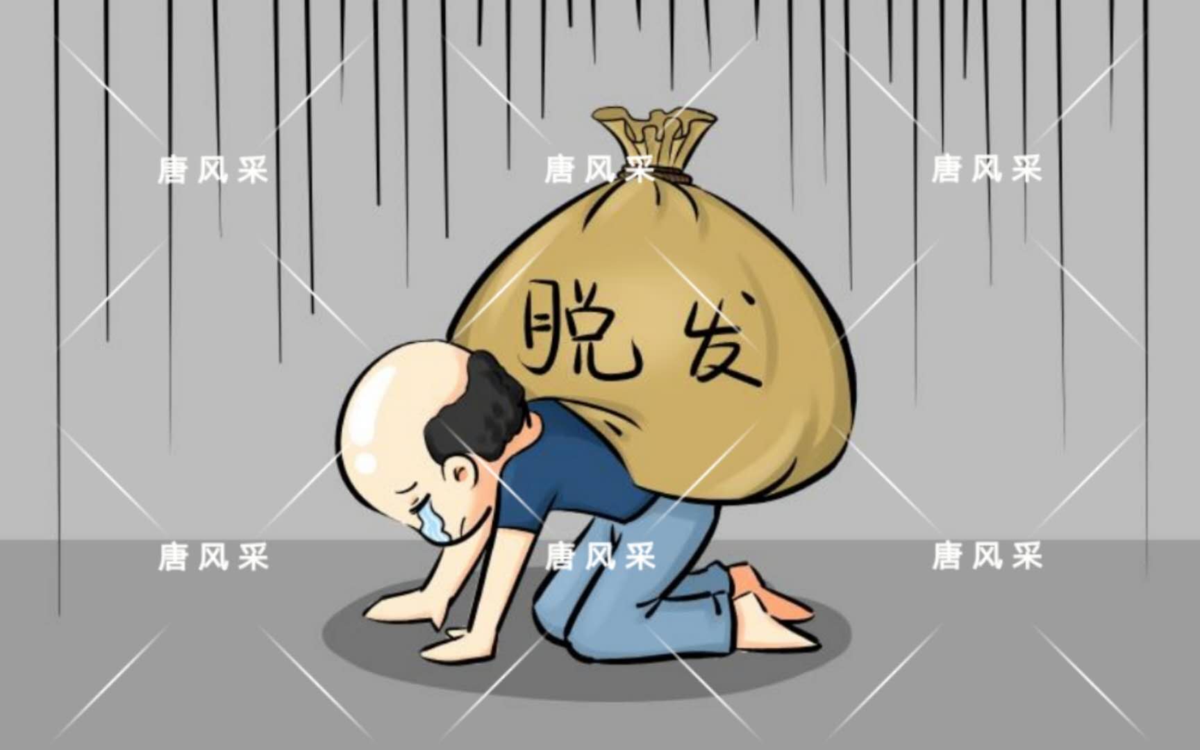 男人脫發原因 男人脫發原因多,不能一味怨腎虧!