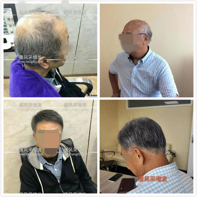 男老人假發 男老人假發超薄設計,這樣的逼真效果你絕對沒見過!