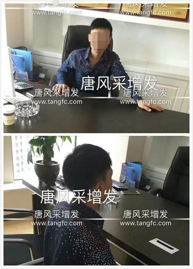 脫發人群 你想知道的所有事,時間會替我告訴你!