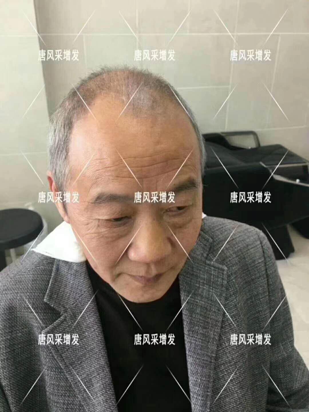 白頭發 常按這個穴位好處多多 有助睡眠還能減少白頭發!