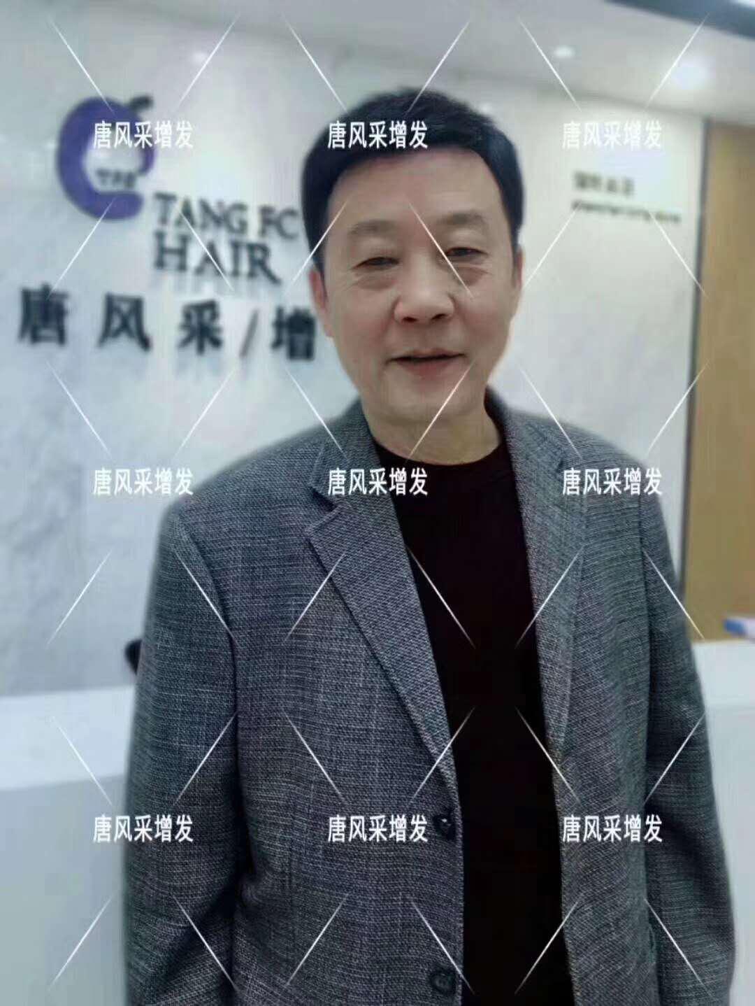 白頭發 常按這個穴位好處多多 有助睡眠還能減少白頭發!