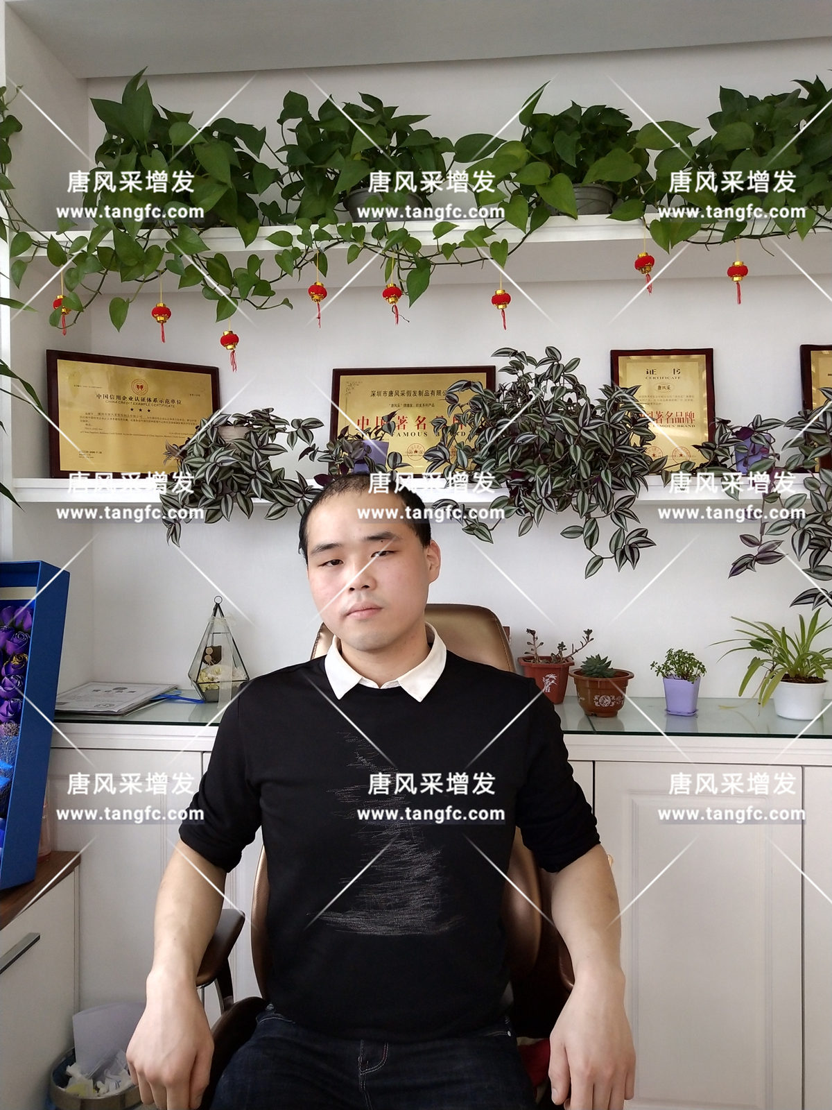 增發(fā)還是植發(fā) 增發(fā)還是植發(fā),這是個問題!