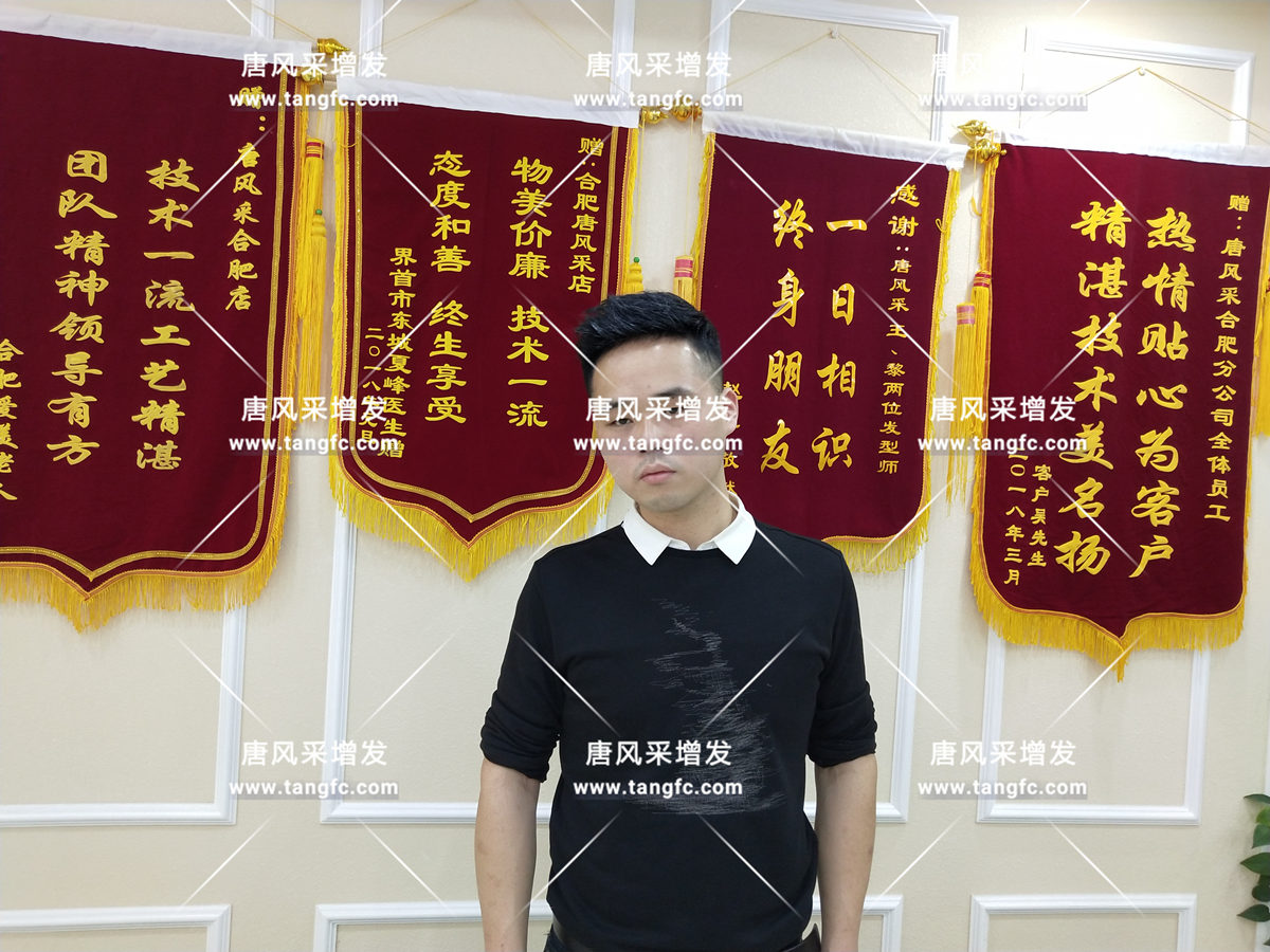 增發(fā)還是植發(fā) 增發(fā)還是植發(fā),這是個問題!