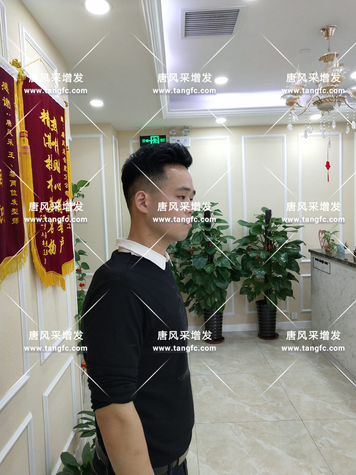 增發(fā)還是植發(fā) 增發(fā)還是植發(fā),這是個問題!