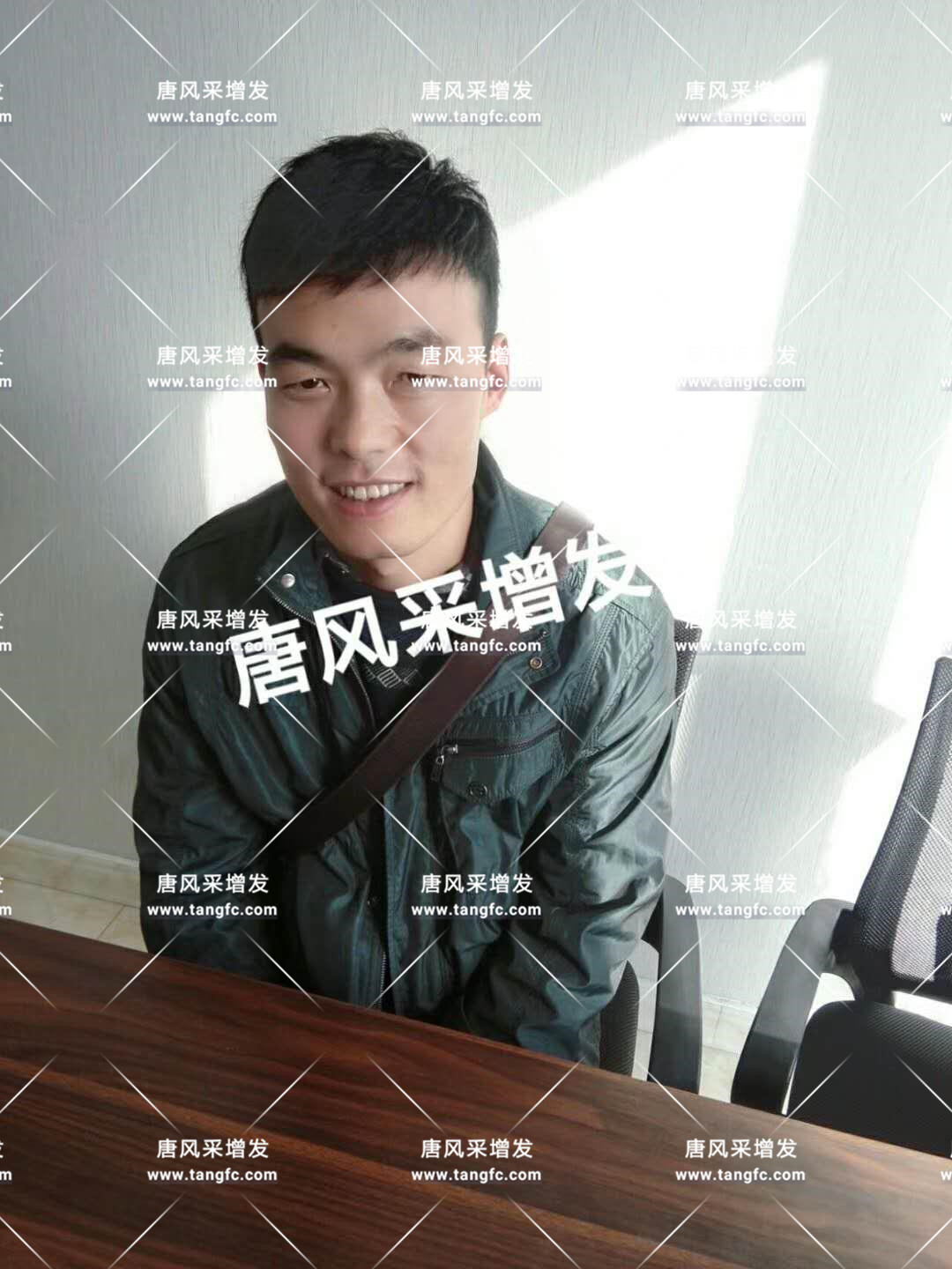 頭發(fā)稀疏 老天對年輕人開了一個(gè)很大的玩笑!