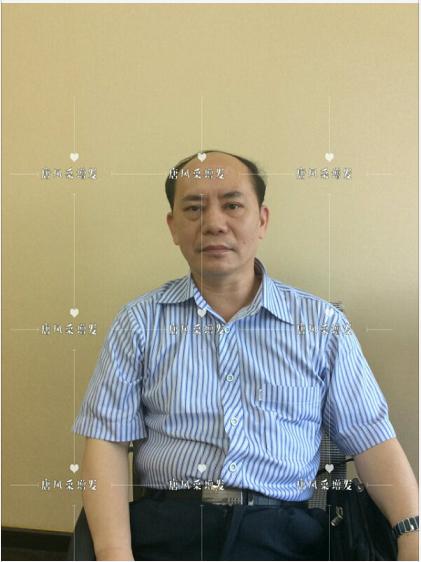 存款重要還是頭發(fā)重要 存款重要還是頭發(fā)重要?聽聽李先生怎么說!