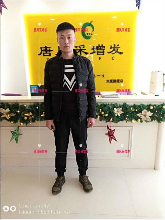 唐風(fēng)采助力脫發(fā)新青年 好形象擁抱新生活,唐風(fēng)采助力脫發(fā)新青年!