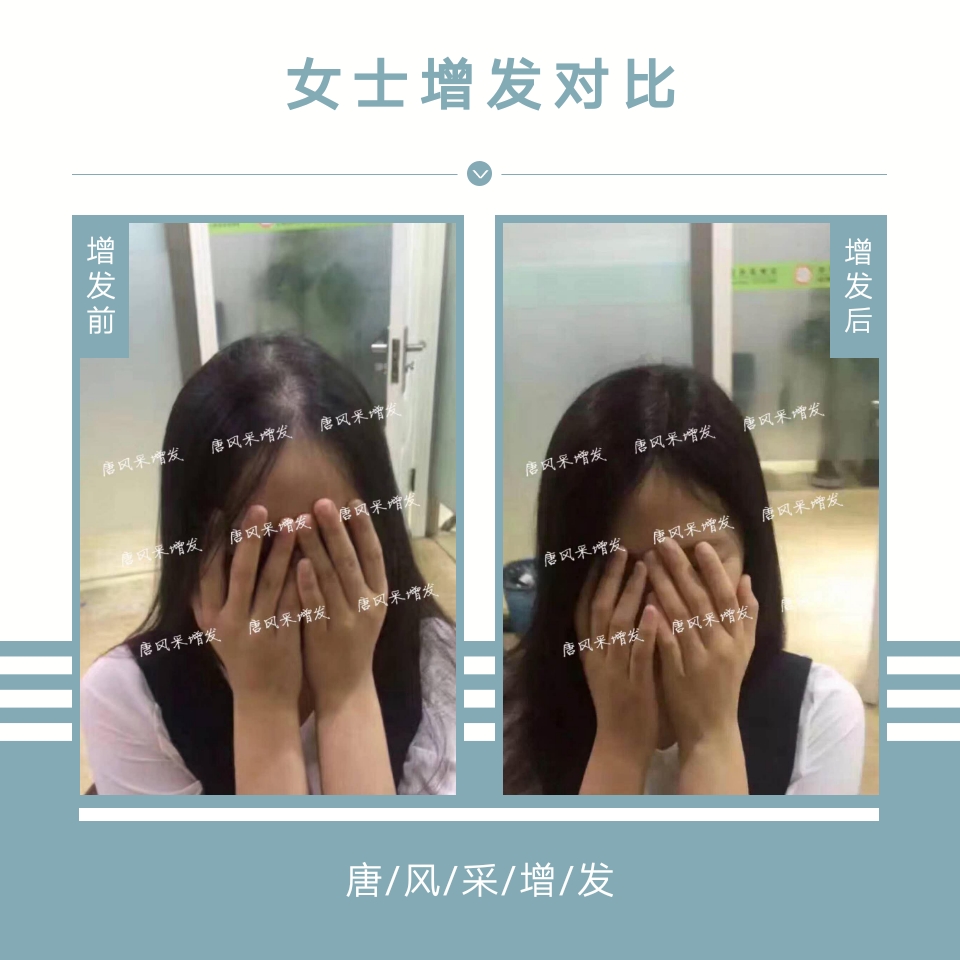 把媽媽的青春留住! 母親節(jié):我能想到最美好的事,就是把媽媽的青春留住!