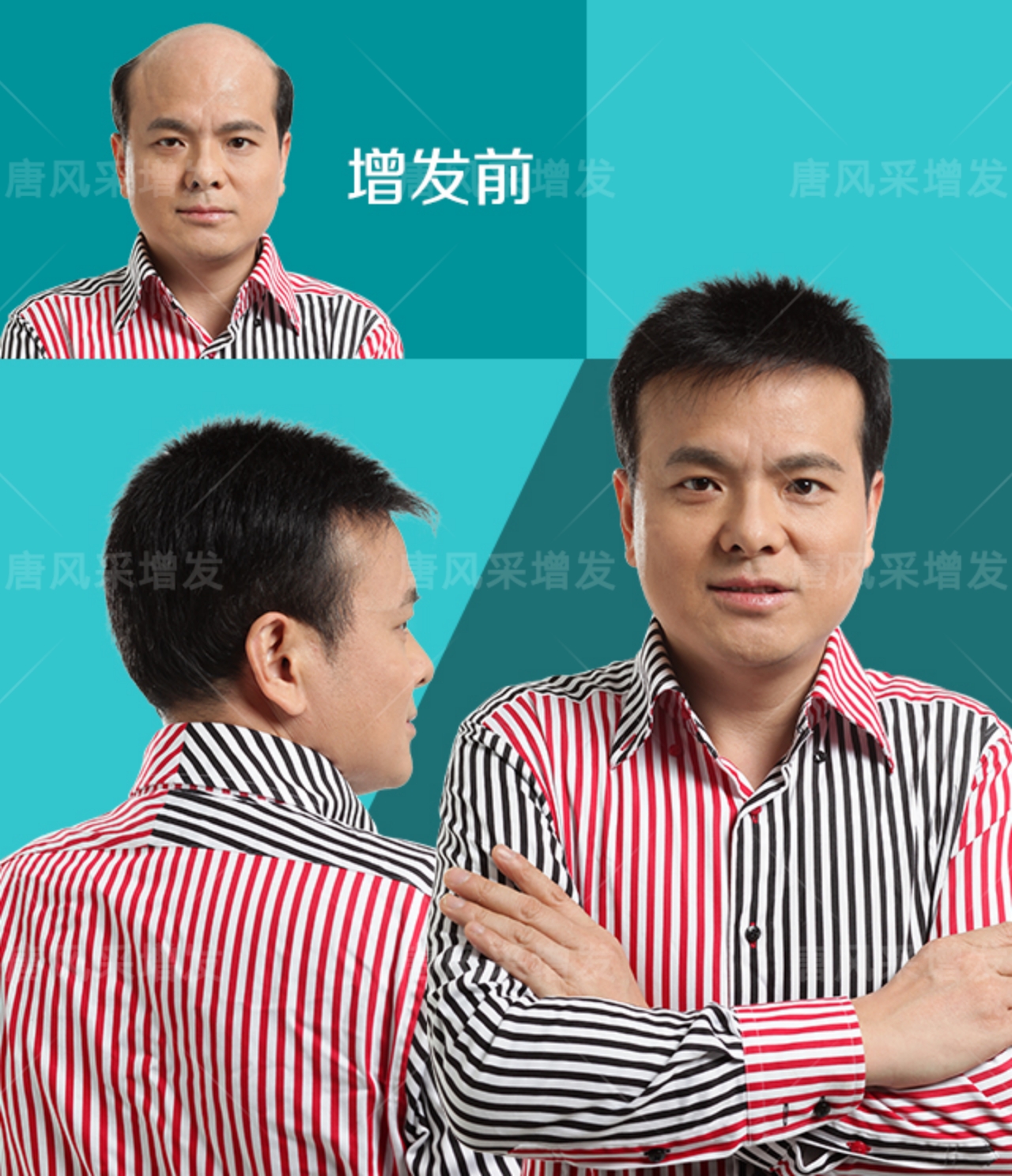 頭發(fā)稀疏 稀發(fā)不哭!終于知道頭發(fā)稀疏可以這樣做!